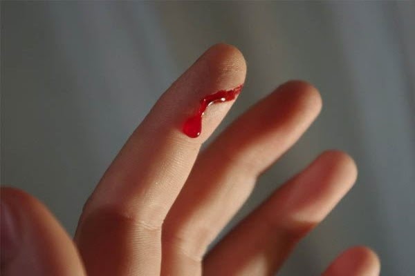 Mơ thấy bị đứt tay c&oacute; &yacute; nghĩa g&igrave;?
