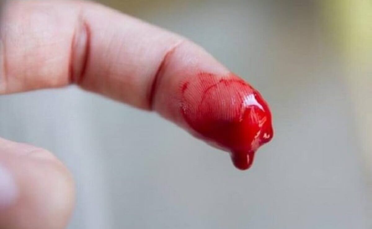 Nằm mơ thấy đứt tay đ&aacute;nh đề con g&igrave;?