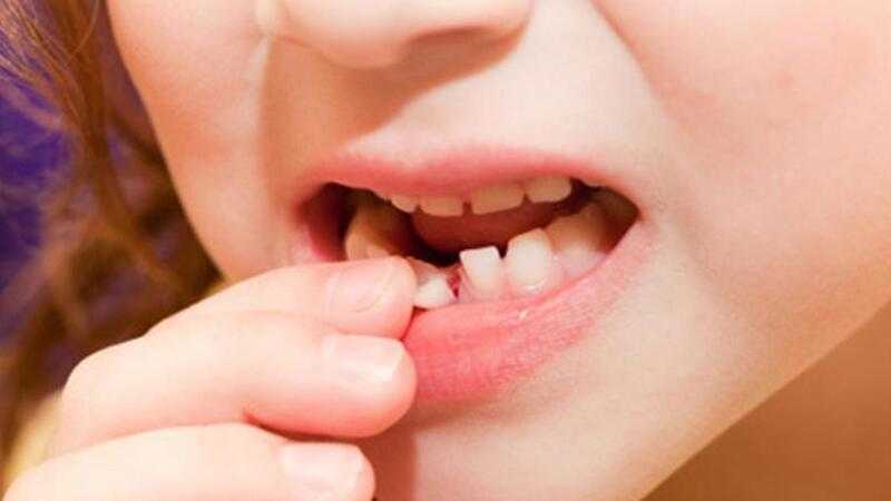 Luận giải giấc mơ thấy rụng răng là điềm tốt hay xấu