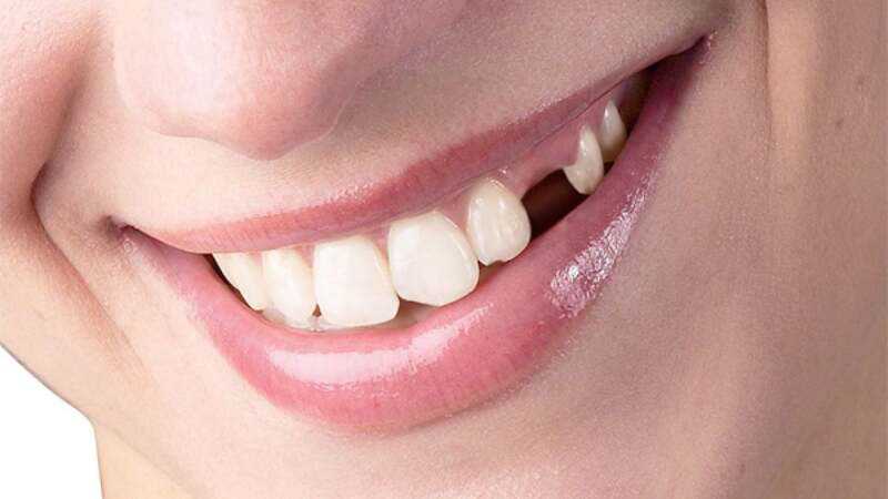 Mơ thấy rụng răng nên đánh con lô gì may mắn nhất